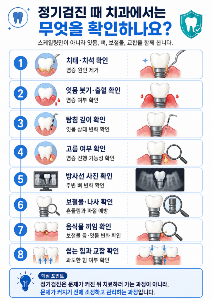 임플란트 관리법과 정기검진 주기