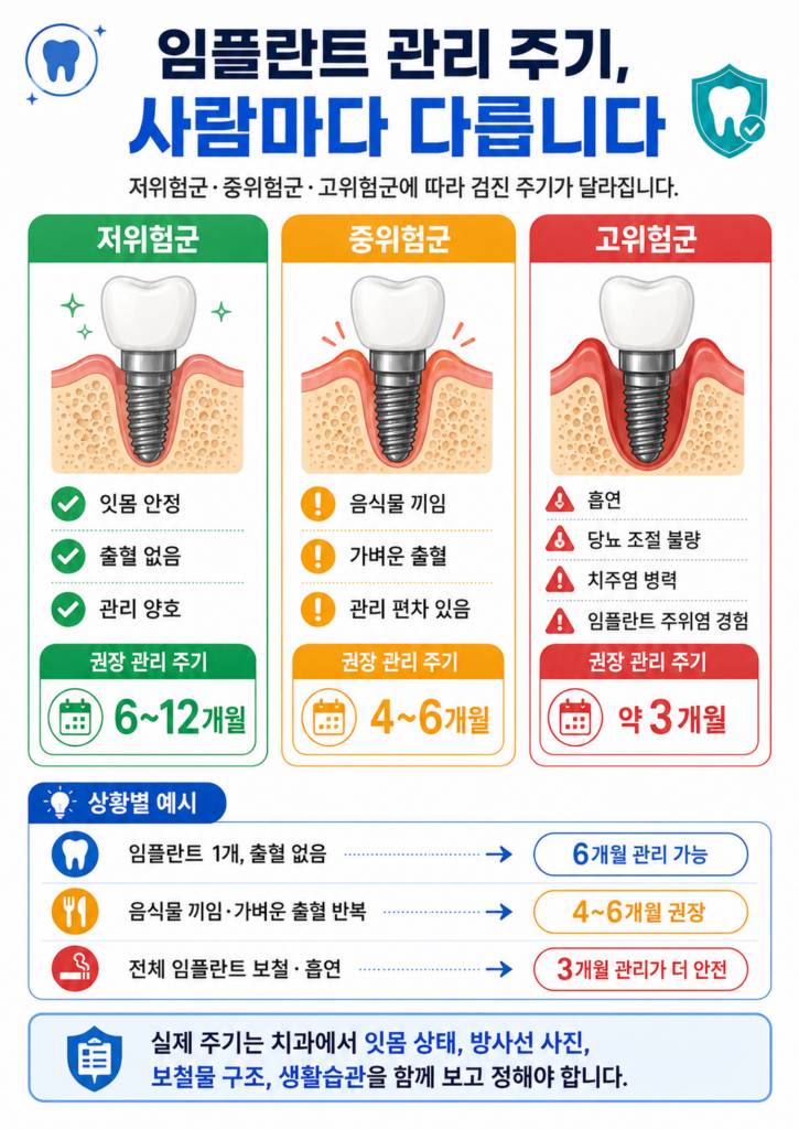 임플란트 관리법과 정기검진 주기