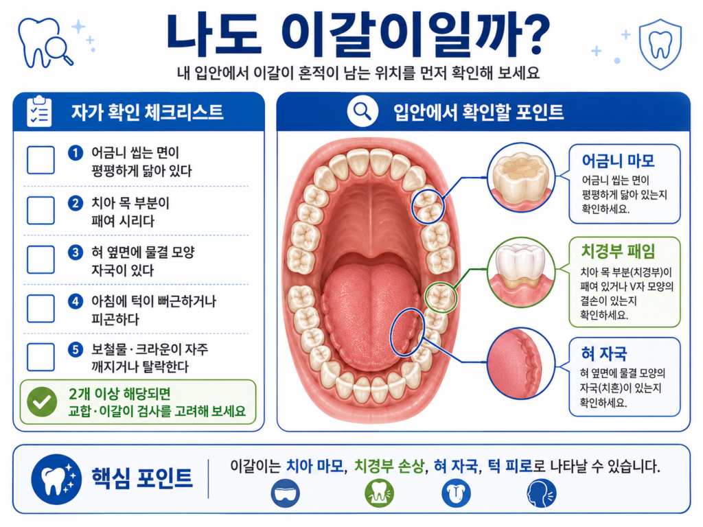 이갈이가 치아수명을 줄이는 과정